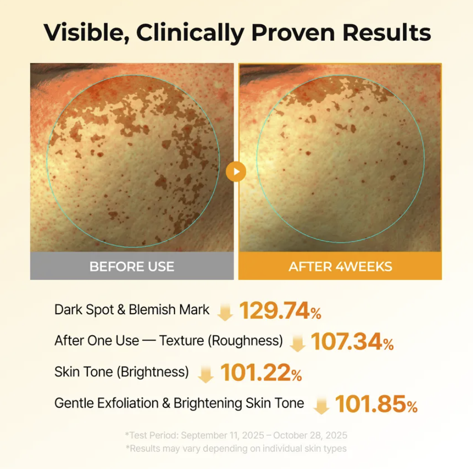 Brightening Toner Pads – Kojic Acid, Tranexamic Acid & Turmeric Exfoliating Pads for Dark Spots & Uneven Skin Toneoduct